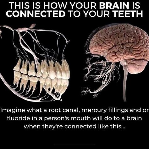 this is how your brain is connected to your teeth Teeth Health, Medical Knowledge, Health Knowledge, Natural Health Remedies, Heavy Metals, Back To Nature, Homeopathy, Health Info, Brain Health