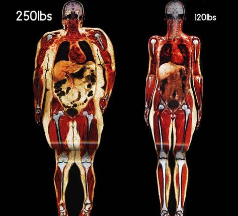 This really puts things into perspective. Be Healthy! Psa Poster, Daglig Motivation, Exercise Benefits, Fitness Memes, Ideal Protein, Body Scanning, The Human Body, I Work Out, Coffee Break