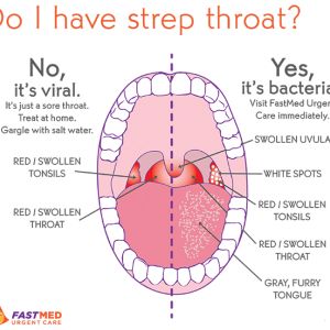 Strep Throat Symptoms, Strep Throat Remedies, Swollen Tonsils, School Nurse Office, Throat Remedies, Sore Throat Remedies, Throat Infection, Sick Remedies, Strep Throat