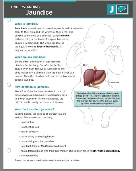 Jaundice. Jaundice Notes, Nicu Nursing Education, Nicu Nurse Education, Newborn Assessment, Neonatal Nursing, Obstetrics Nursing, Vintage Disney Art, Midwifery Student, Newborn Nursing