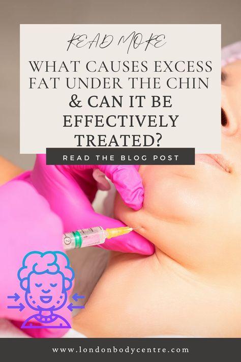 The double chin, also known as submental fat, is a common cosmetic concern that affects many individuals. While it can be attributed to various factors, the good news is that there are effective treatments available to target and reduce excess fat under the chin. In this comprehensive guide, we will explore the causes of excess chin fat, the science behind its formation, and the range of treatments that can effectively address it. We'll also provide valuable insights and tips Under Chin Fat How To Get Rid Of, Double Chin Injection, Triple Chin, Fat Dissolving Injections, Chin Filler, Top Treatments, Face Wrinkles, Fat Removal, Dermal Fillers