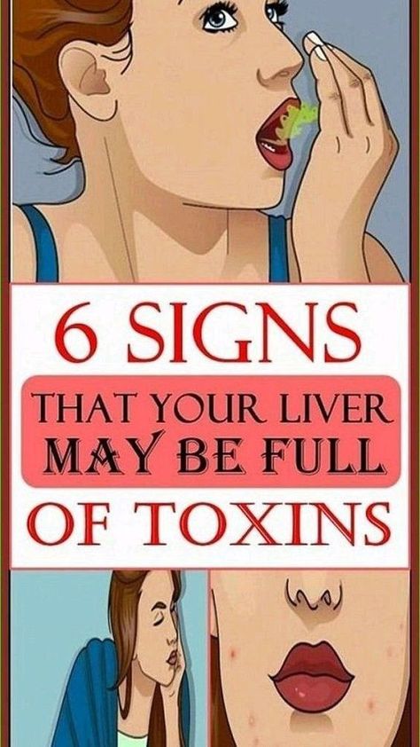 6 signs that your liver is full of toxins #LiverDetox #ToxinFreeLife #HealthyLiver #DetoxTips #CleanseYourBody #LiverHealth #ToxinFlush #NaturalDetox #LiverCleanse #ToxinFreeLiving Signs Of Liver Damage, Importance Of Sports, Benefits Of Oranges, All Body Systems, Women Wellness, Liver Damage, Benefits Of Drinking Water, Healthy Living Inspiration, Healthy Living Motivation