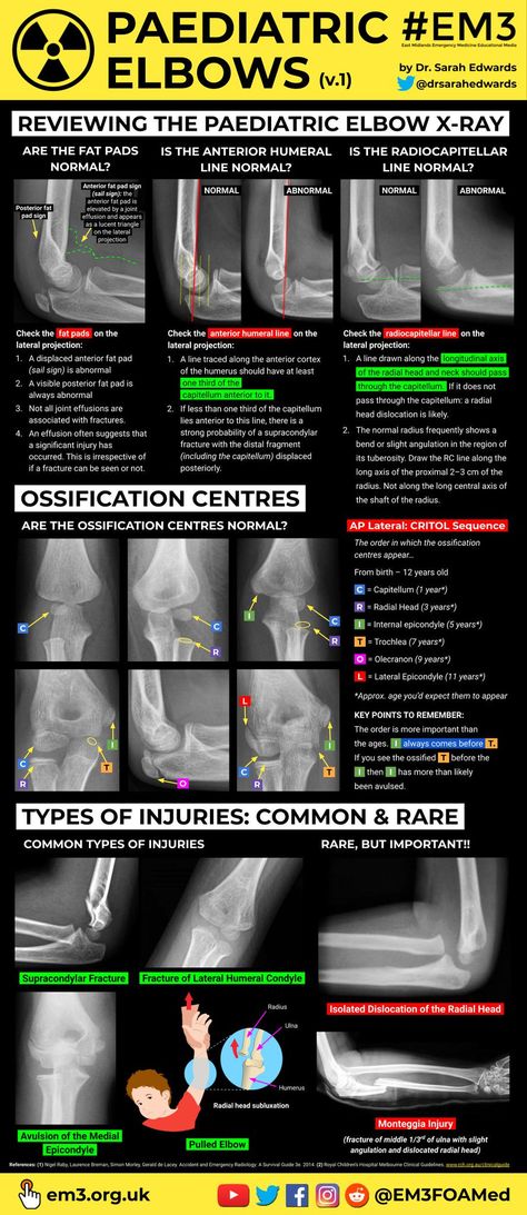 Radiography Student, Rad Tech Student, Radiology Schools, Medical Radiography, Medical Assistant Student, Radiology Student, Radiology Technician, Radiology Imaging, Radiology Tech