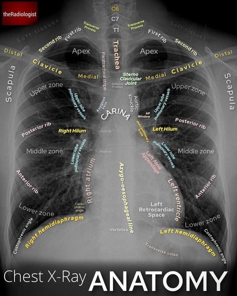 The Radiologist Chest Anatomy, Radiologic Technology, Radiology Imaging, Medical Imaging, Anatomy Study, Radiology, Physical Therapy, Anatomy, Nursing