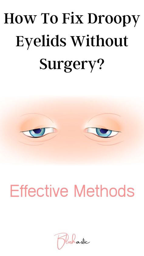 Though there are various surgical methods to fix these droopy eyelids, some people might not prefer going under the knife. If you are in this situation too and wonder, ‘How to fix droopy eyelids without surgery?’ then you are at the right place. Fix Droopy Eyelids, Makeup For Droopy Eyelids, Saggy Eyes, Saggy Eyelids, Drooping Eyelids, Homemade Wrinkle Cream, Droopy Eyelids, Droopy Eyes, Eye Exercises