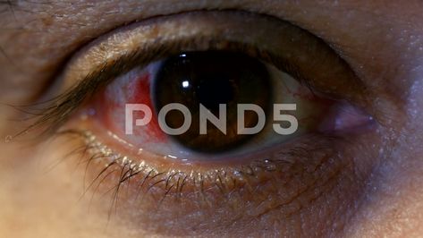 Close-up shot open sick male eye with blood vessels Stock Footage #AD ,#sick#male#open#Close Blood Shot Eyes, Male Eyes, Alpha Channel, Blood Vessels, Video Footage, Presentation Design, Stock Video, Stock Footage, Close Up