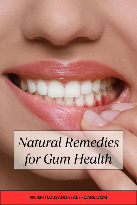 Natural Remedies for Gum Health.Discover the best natural remedies for improving your gum health and preventing gum disease. Learn how to support your oral health the natural way. Healing Gums Naturally, Irritated Gums Remedies, How To Heal Gums Naturally, Heal Receding Gums Naturally, Natural Gum Repair, Healthy Gums Remedies, Sore Gums Remedy Natural, Gum Swelling Remedies, Inflamed Gums Remedies