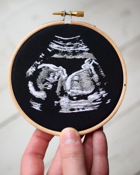 Artist Stitches Ultrasound Embroideries to Commemorate Special Moment Ultrasound Embroidery, Baby Ultrasound, Embroidery Hoop Art Diy, Embroidered Portrait, 5 Elements, Baby Embroidery, Thread Painting, Unique Baby Shower, Hand Embroidery Art