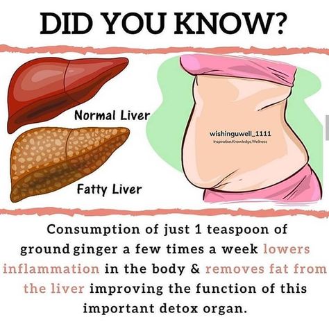 Do You Add Ginger or Ginger Powder To Your Meals? 🌱 _  Please protect your liver. Exposure to harmful toxins or excessive fat accumulation… Ginger Powder Benefits, Health Benefits Of Ginger, Ginger Powder, Health Tonic, Lower Inflammation, Ginger Benefits, Healthy Liver, Fat Removal, Liver Health