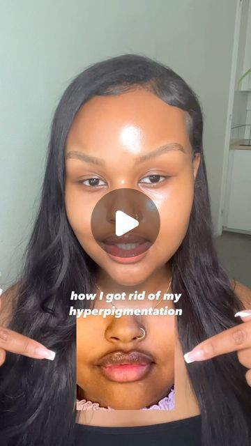 Kadija Ali on Instagram: "I tried a lot of different products but only started seeing results once I started using sunscreen in my skincare routine.   Wearing sunscreen in combination with tyrosinase inhibitors (alpha arbutin, tranexamic acid, azelaic acid etc), chemical exfoliants & retinoids will target and fade hyperpigmentation!  Do you wear sunscreen? 🤍" Sunscreen For Combination Skin, Tyrosinase Inhibitors, Skincare Combination, Products For Hyperpigmentation, Fade Hyperpigmentation, Combination Skin Routine, Skincare For Combination Skin, Sensitive Skin Care Routine, My Skincare Routine