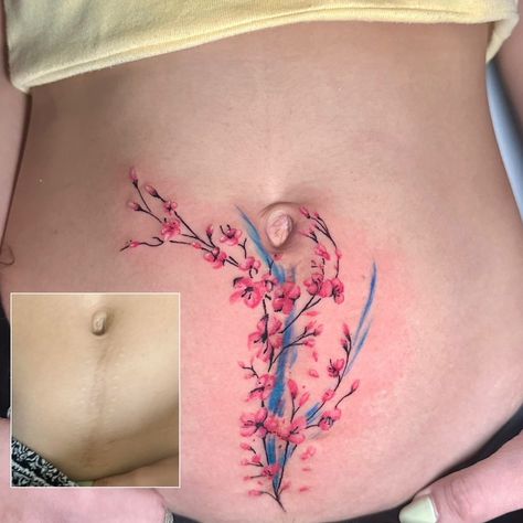 Scar cover up Scar Cover Up, Belly Tattoo, Girl Tattoos, Tattoos For Women, Bangkok, Cover Up, Tattoos, Pins, Tattoo Girls