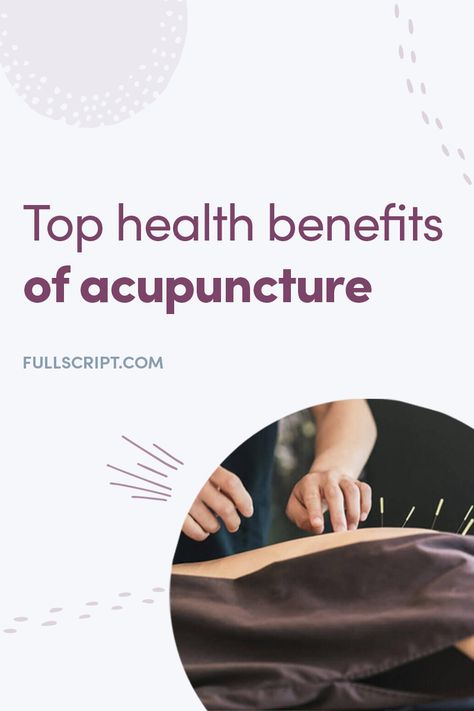 Benefits Of Acupuncture, Acupuncture Benefits Facts, Accupunture Benefits Health, Cupping Points, Traditional Chinese Medicine Acupuncture, Acupuncture Benefits, Acupressure Massage, Cupping Therapy, Massage Benefits