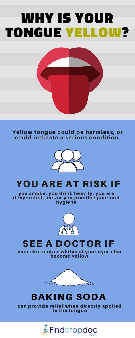 Yellow tongue is a harmless condition that causes a thick, yellow coating on the tongue. Yellow tongue tends to appear when dead skin cells, bacteria, or discoloring particles become trapped or buildup on the tongue's surface. #Health  #Fitness  #HealthyLiving  #TongueYellow Yellow Tongue, Tongue Health, The Tongue, Top Videos, Mouthwash, Oral Hygiene, Dental Care, Dead Skin, Baking Soda