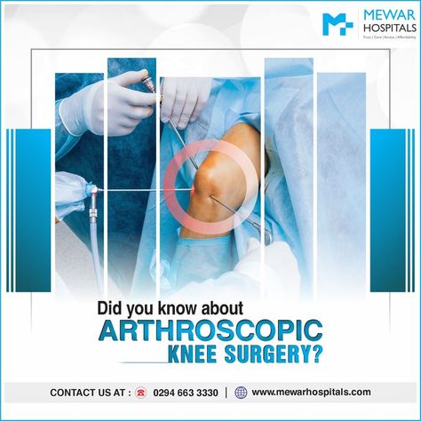 Arthroscopic Knee Surgery is a surgical procedure that allows doctors to view the knee joint without making a large incision (cut) through the skin and other soft tissues for more details Call: 0294 663 3330. #mewarhospitals #knee #kneepain #arthroscopic #kneesurgery #surgery #tissues #joint #jointpain #trending #informativepost #udaipur #mewar #bones #kneepaintreatment Arthroscopic Knee Surgery, Knee Replacement Surgery, Knee Surgery, Knee Replacement, Udaipur, Knee Pain, Surgery, The Knee, Disease