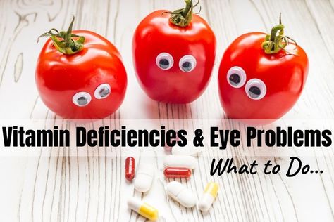 vitamin deficiencies and eye problems Eye Twitch, Eye Twitching, Eye Problems, Vitamin Deficiency, Blurry Vision, Vision Eye, Healthy Eyes, Eyes Problems, Eye Health