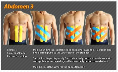 Kinesiology taping instructions for the abdomen #ktape #abdomen #ares K Tape, Kinesio Tape, Kt Tape, Kinesio Taping, Tulane University, Abdominal Surgery, Stomach Cramps, Workout Stuff, Kinesiology Taping