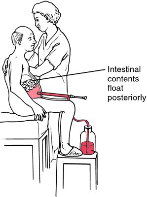 paracentesis - definition of paracentesis in the Medical dictionary - by the Free Online Medical Dictionary, Thesaurus and Encyclopedia. Paracentesis Nursing, Nursing School Clinicals, Registered Nurse School, Nursing Interventions, What Is Nursing, Clinical Nurse Specialist, Nursing Scholarships, Nursing School Prerequisites, Lpn Schools