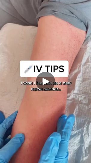 325K views · 5.7K reactions | Useful tips for starting an IV. Video Cred: BeautifulNursing | Things Nurses Do | Things Nurses Do · Original audio Iv Line, Central Line, Pharmacology, Nursing Notes, Helpful Hints, Audio, The Originals