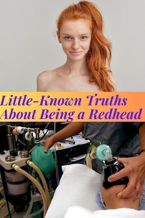 People With Red Hair, Kueez Pins, Bright Red Hair, Isla Fisher, Will And Grace, Going Gray, Viral Trend, Best Actress, Viral Pins