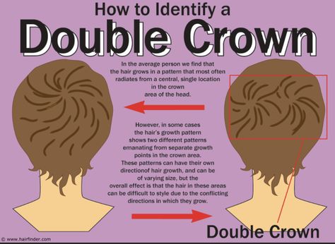 Crown Meaning, Double Crown Hairstyles, Hair Whorl, Hair Growth Patterns, Kinds Of Haircut, Crown Hair, Top Hairstyles, Spiral Shape, Athletic Hairstyles