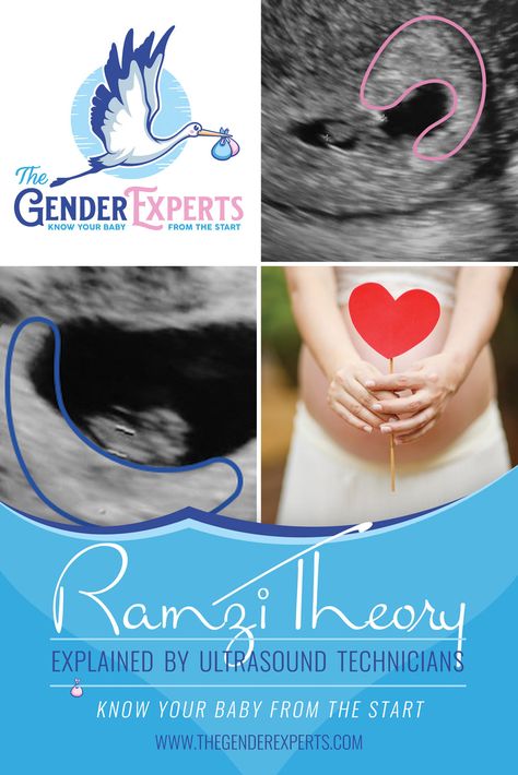 Baby Heart Rate Gender, Chinese Gender Calculator, Mayan Calendar Gender, Gender Calculator, Gender Prediction Calendar, Ultrasound Gender Prediction, Ramzi Method, Chinese Gender Prediction, Ramzi Theory