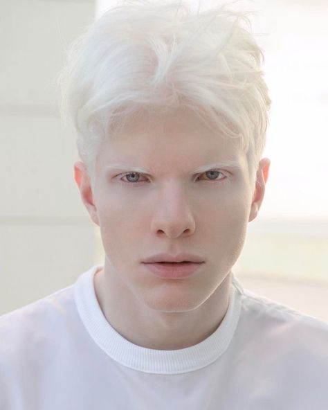 Albino Model, Vacation Miami, French Vacation, Boy With White Hair, Cats Family, Digital Portrait Art, Manx, Aesthetic People, Celebrity Tattoos