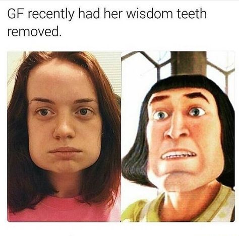 53 Savage AF Memes For Funny People - Funny Gallery Wisdom Teeth Meme, Dental Instagram, Wisdom Teeth Funny, Savage Af, Bright Quotes, Photos Funny, Bad Kids, Wisdom Teeth, Funny Picture Quotes