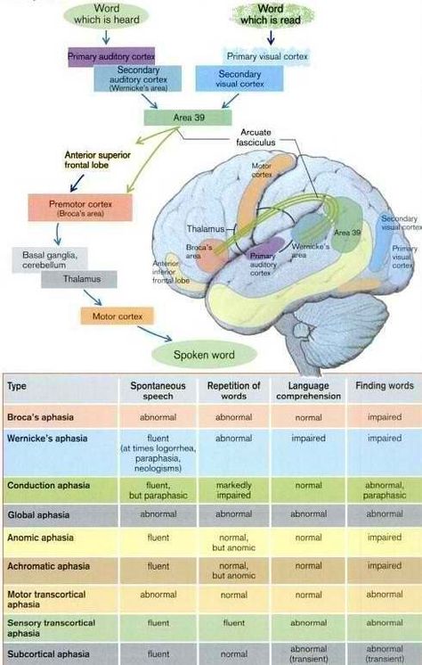 Great Layout of Aphasia Types Brain Anatomy, The Human Brain, Speech Pathology, Speech Language Therapy, Medical Knowledge, Speech Language Pathology, Speech Therapy Activities, Speech Language Pathologists, Language Therapy