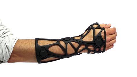 3D Printed Orthotics: 7 Most Promising Projects in 2020 | All3DP Magic Prosthetic Arm, Heal Broken Bones, Vr Device, Army Helmet, Football Gloves, 3d Printing Diy, Wearable Technology, Miu Miu Ballet Flats, Print Magazine