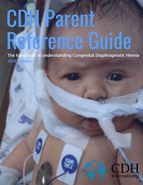 CDH News -CDHi created the first parent guide for Congenital Diaphragmatic Hernia … The post CDH Parent Reference Guide appeared first on CDH International - A Global Initiative to Stop Congenital Diaphragmatic Hernia. Cdh Awareness, Parental Advisory, Parenting Guide, Trivia, Labor, The First, Medical, Parenting