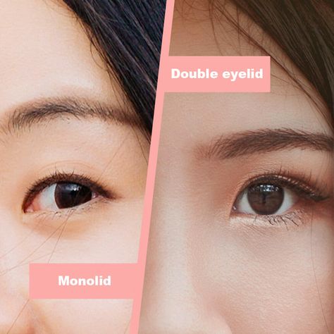 Double Eyelids, Double Eyelid