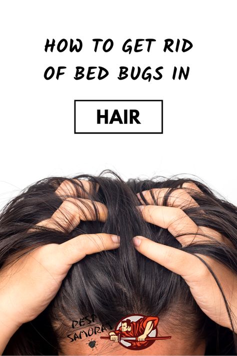 Can bed bugs get in your hair and how to get rid of bed bugs from your hair? There are various ways and products of getting rid of bed bugs from your hair. In this article, you can find out everything you need to know about bed bugs in hair. Read more about bed bugs infestation and learn how to remove bed bugs and bed bugs eggs from the hair. #bedbugs #getridofbedbugs #preventbedbugs #stopbedbugs Honey And Lemon Drink, Bug Bites Remedies, Getting Rid Of Phlegm, Get Rid Of Bed Bugs, Kill Bed Bugs, Rid Of Bed Bugs, Bed Bug Bites, Honey Benefits, Turmeric Health Benefits