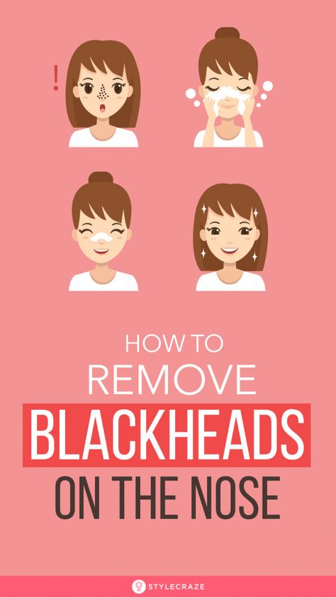 Just Rub Your Skin With This Spice Whiteheads Removal, Homemade Makeup Remover, Acne Hacks, Remove Blackheads From Nose, Spotless Skin, Blackheads On Nose, Black Heads, Blackhead Mask, Face Tips