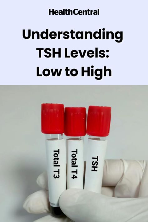 Tsh Hormone, Low Tsh, High Tsh Levels, Thyroid Ultrasound, Overactive Thyroid, Thyroid Levels, Low Thyroid, Thyroid Function, Thyroid Issues