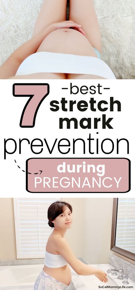 Pregnancy can be a beautiful time, but it's also a time when your body is going through a lot of changes. One common concern for mamas to be is stretch marks. Here are seven tips for preventing… More Pregnancy Safe Skin Care, Stretch Mark Prevention, Going Through A Lot, Pregnancy Calculator, First Time Pregnancy, Planning Pregnancy, Pregnancy Labor, All About Pregnancy, Pregnancy Essentials