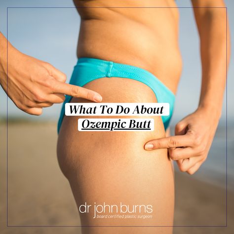 What To Do About Ozempic Butt- by Dallas Plastic Surgeon, Dr. John Burns Flat Buttocks Before And After, Ozempic Before And After Photos, Panniculectomy Before And After, Ozempic Before And After, Fat Transfer To Buttocks, Skin Resurfacing, Receding Gums, Saggy Skin, Laser Skin