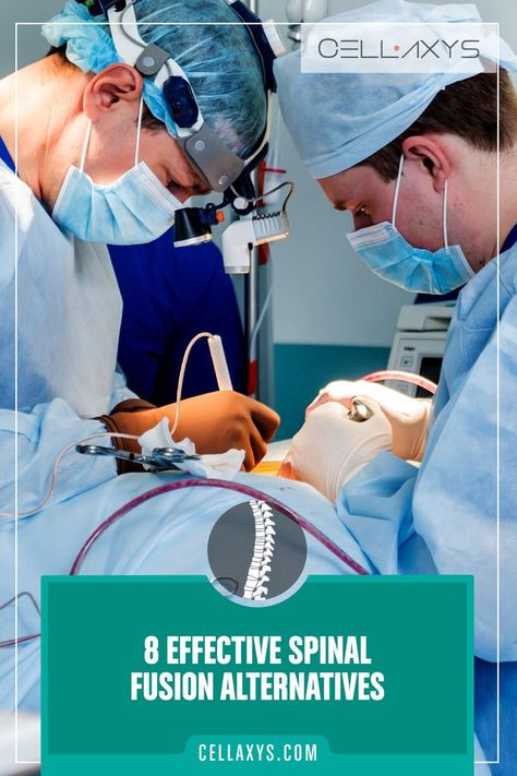 8 Effective Spinal Fusion Alternatives Spinal Fusion Surgery, Mayo Clinic Diet, Lumbar Pain, Spinal Fusion, Spinal Surgery, Neck Surgery, Spine Surgery, Mayo Clinic, After Surgery