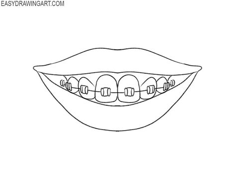 braces drawing lesson Braces Drawing Anime, Teeth With Braces Drawing, Smile With Braces Drawing, How To Draw Braces, Braces Drawing Reference, Drawing Braces, Braces Drawing, Sketch Mouth, Work Doodles