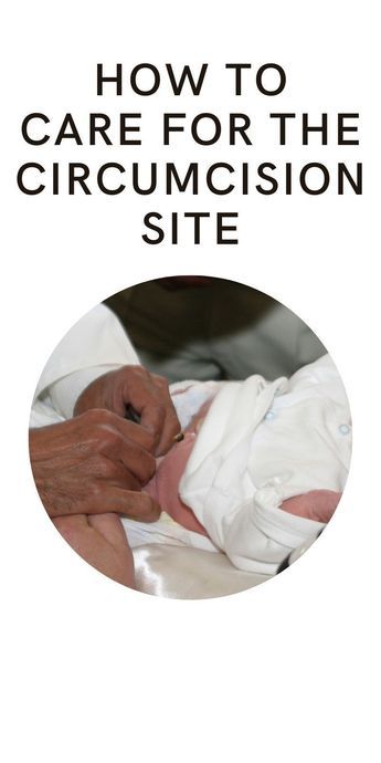 Baby Circumcision Care, Newborn Circumcision Care, Circumcision Care Newborn, Baby Hygiene, Newborn Advice, Newborn Baby Tips, How Do You Clean, Parenting Ideas, Parent Life