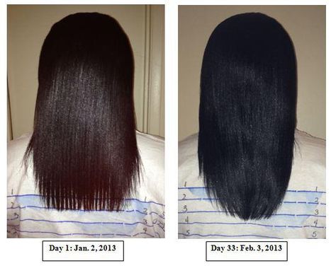 Hairfinity before and after pic...I think I'm gonna start taking these again Before And After Hair Growth, Before And After Hair, Vitamins For Healthy Hair, Faster Hair Growth, Hair Facts, Hair Mask For Growth, Haute Hair, Healthy Hair Care, Healthier Hair