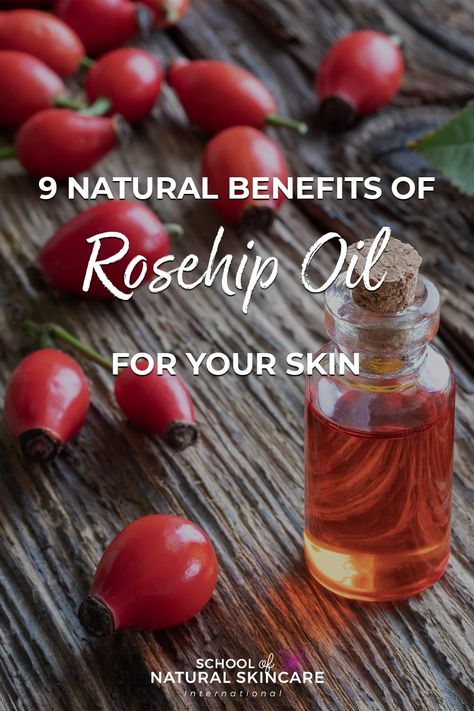 Benefits Of Rosehip Oil, Rosehip Recipes, Oils For Dry Skin, Rosehip Oil For Skin, Oil Benefits For Skin, Rosehip Oil Benefits, Oil Skin Care Routine, Natural Skin Care Ingredients, Natural Beauty Recipes