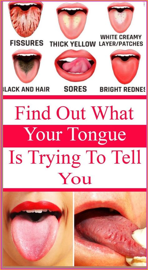 What Your Tongue is Trying to Tell You About Your Health Tongue Scraper, Endocannabinoid System, Health Signs, Tongue Health, Nail Health, What’s Going On, Health Remedies, Healthy Tips, Ayurveda