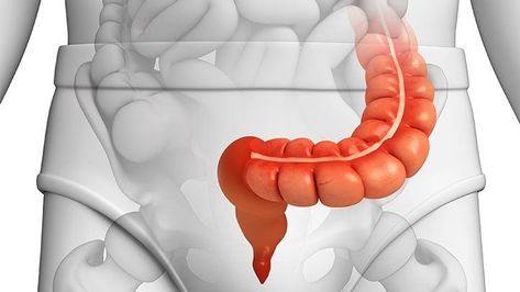 How Diverticulitis Affects the Sigmoid Colon Tips For Constipation, Sigmoid Colon, Low Fiber Diet, Regular Bowel Movements, Types Of Herbs, Bowel Movement, Fiber Diet, Natural Colon Cleanse, Large Intestine