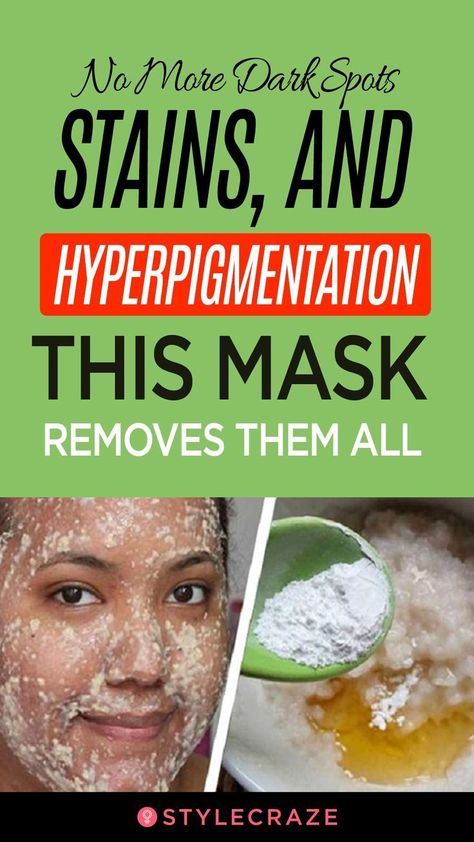 No More Dark Spots, Stains, And Hyperpigmentation: This Mask Removes Them All #beauty #tips beautytips Overnight Beauty Tips, Vaseline Beauty Tips, Tips For Makeup, Aloe Vera Skin, Acne Beauty, Beauty Tips Natural, Korean Beauty Tips, Aloe Vera Skin Care, Eyeliner Tips