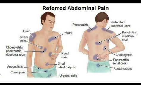 Referred Pain (Physical Diagnosis) Assessment Nursing, Nursing Information, Nursing Board, Referred Pain, Nursing Assessment, Family Nurse Practitioner, Nurse Rock, Medical School Studying, Medical School Essentials