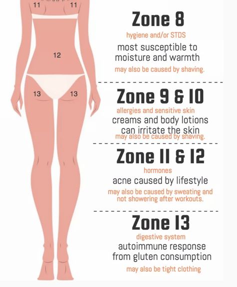 Acne body mapping Body Acne Map, Acne Map, Remedies For Back Acne, Body Points, Back Acne Remedies, Back Acne, Body Mapping, Cleaning Your Ears, Body Map