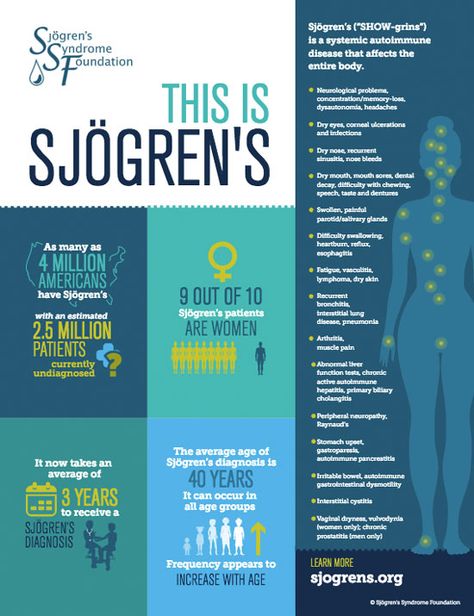 VM - Learning More About Sjögren’s Syndrome and Its Impact on Eyes Dental Decay, Sjogrens Syndrome, Health Cleanse, Autoimmune Disorder, Invisible Illness, Abdominal Pain, Chronic Fatigue, Autoimmune Disease, Migraine