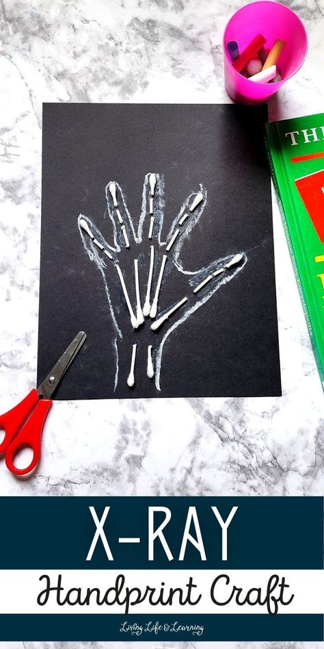 X Ray Preschool Craft, Bone Crafts Diy, Human Body Crafts For Kids, Skeletal System Activities, Human Body Crafts, Human Body Lesson, Homeschool Science Lessons, Human Body Worksheets, Human Body Projects