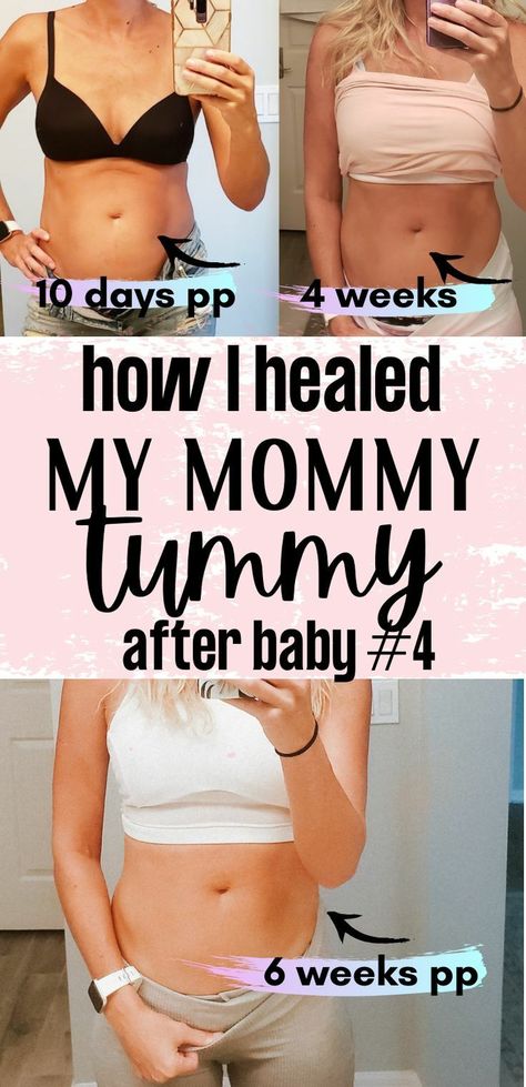 Mommy Workout Mummy Tummy, Mommy Tummy Before And After, Mommy Pooch Before And After, Post Partum Checklist, Mom Belly Workout, Post Partum Belly, Belly After Pregnancy, Belly After Baby, Heal Diastasis Recti