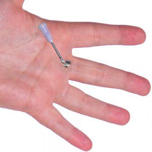 percutaneous-surgery-for-trigger-finger Trigger Finger Exercises, Muscle Tear, Therapy Exercises, Finger Exercises, Types Of Surgery, Trigger Finger, Desk Job, Surgery Recovery, Nerve Damage